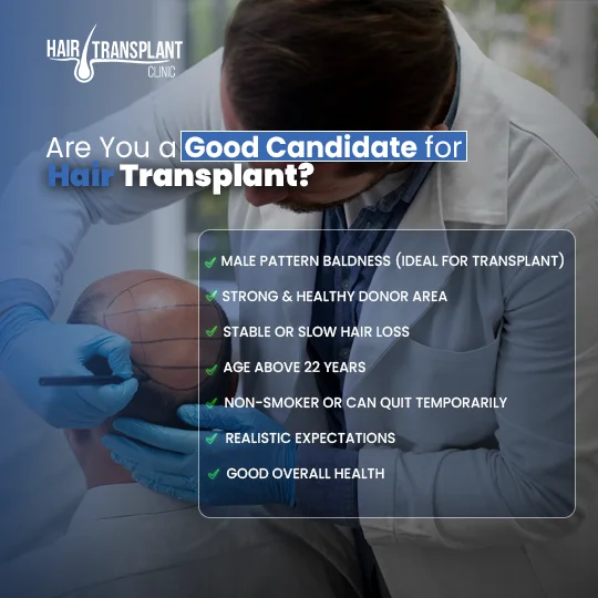 Good candidate for hair transplant with male pattern baldness, healthy donor area and age above 22