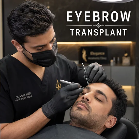 Eyebrow transplant procedure in Pakistan by Dr. Hamza Ahmad expert hair transplant surgeon Lahore