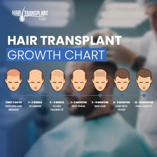Hair transplant growth chart from day 1 to 18 months showing scabbing, shedding and final results