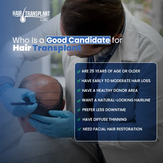 Good candidate for DHI hair transplant with early hair loss, healthy donor area and natural hairline